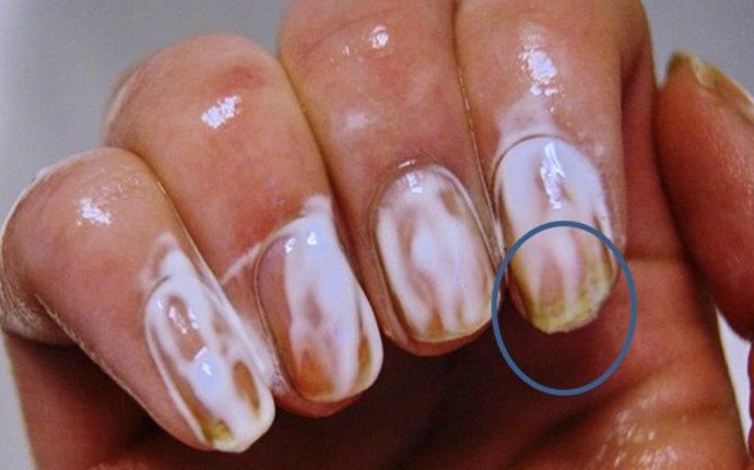 Rub a Little Bit of Toothpaste On Your Nails For Several Minutes