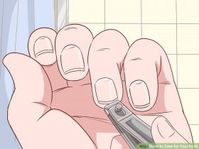 Image titled Recognize and Prevent a Pinworm Infection Step 9