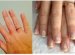 How to get your nails healthy?