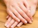 Nail health and nutrition