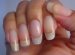 Natural healthy nails