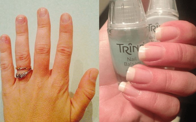 How to make nails healthy again?